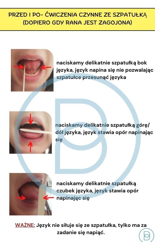 Pod lupą logopedy cz.1