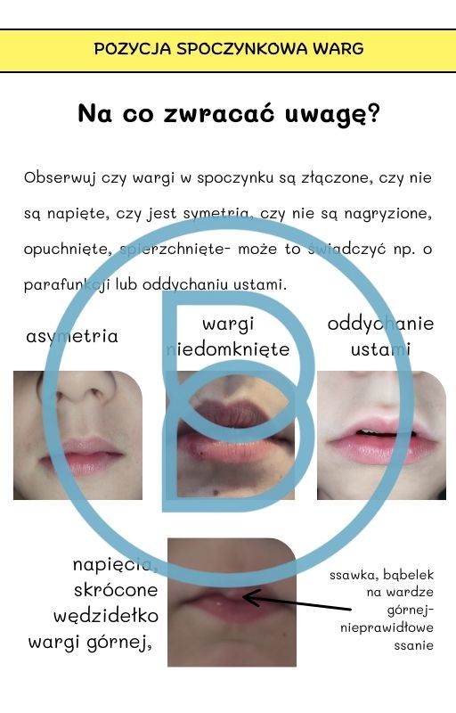 Pod lupą logopedy cz.2