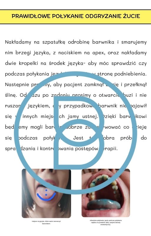 Pod lupą logopedy cz.3